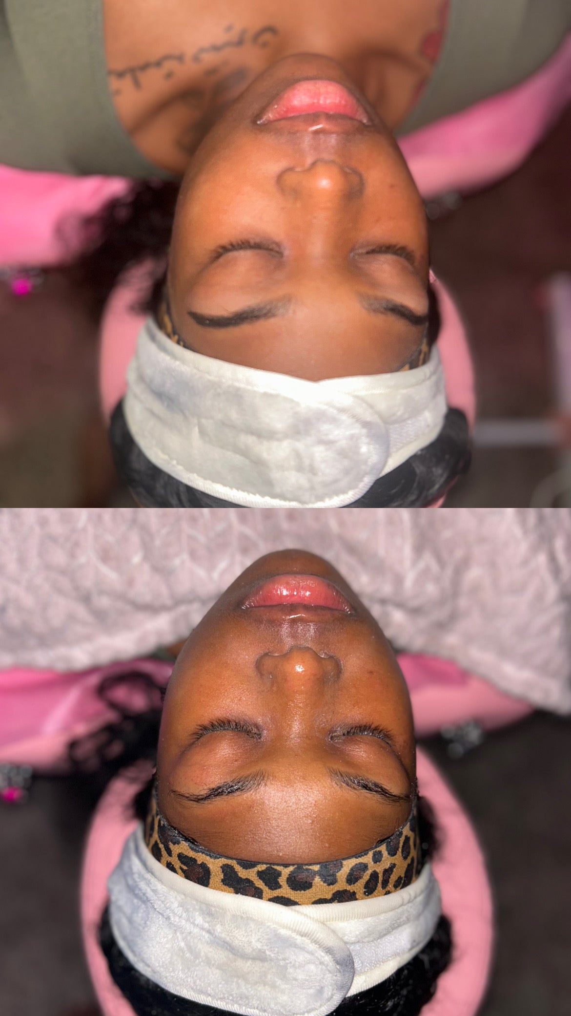 Basic facial